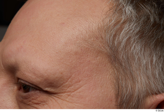 HD Face Skin Agustin Wilkerson eye face forehead skin pores…